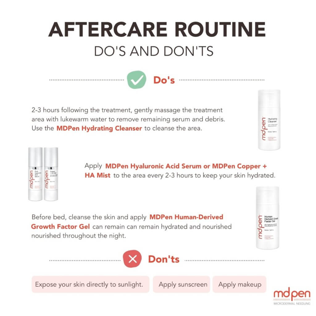 The Perfect Aftercare: MDPen Skin Care Products for Men’s RF Microneedling Treatment