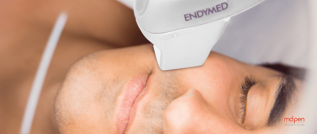 Maximizing Results: Essential Skincare Guide for Men After Microneedling with Radio Frequency