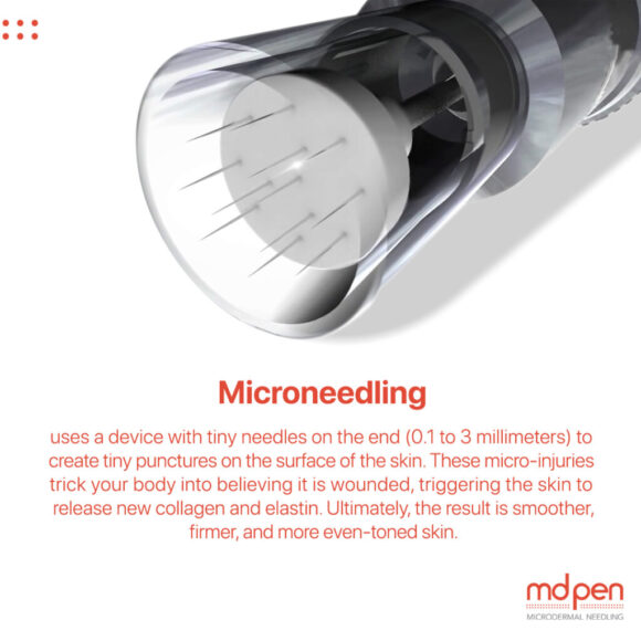 Restore Your Collagen with MDPen Microneedling