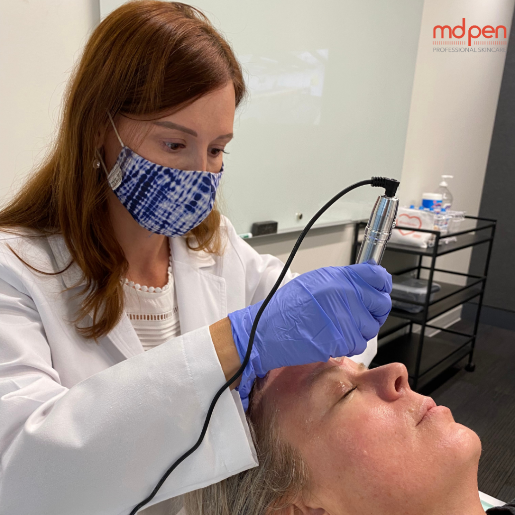 Turn Back Time: How Micro Needling with MDPen Keeps Women Wondering About Your Age