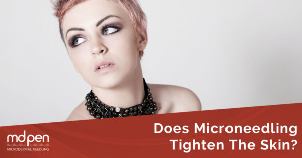 Does MicroNeedling Tighten The Skin?