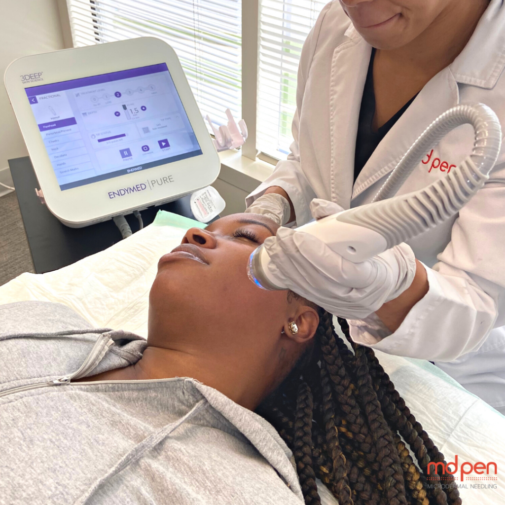 Enhancing Your Radio Frequency Microneedling Results with MDPen Serums