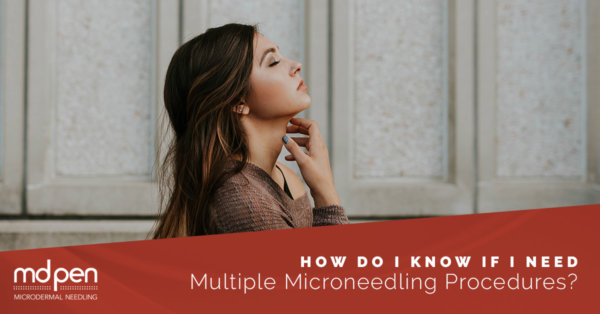 How Do I Know If I Need Multiple microneedling Procedures?