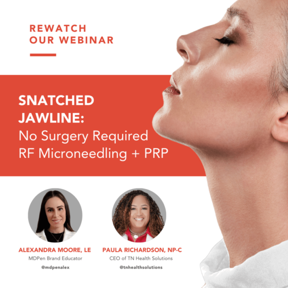 Achieve Your Dream Jawline with EndyMed’s Snatch Jawline Treatment