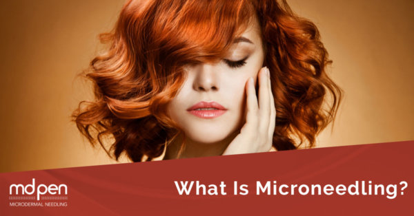 What Is MicroNeedling?