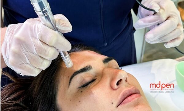 Unveiling the Mysteries of Microneedling: The Ultimate Guide to Healing Your Skin from the Inside-Out!